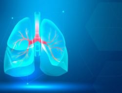 Waspada TBC Laten, Tidak Bergejala Bisa Muncul Kapanpun