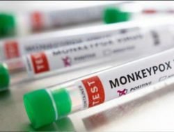 Kemenkes: Belum ada Laporan Kasus Cacar Munyit di Indonesia